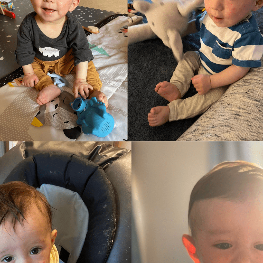 Untitled design-145 Case Study – Gut Health Skin Connection in Babies