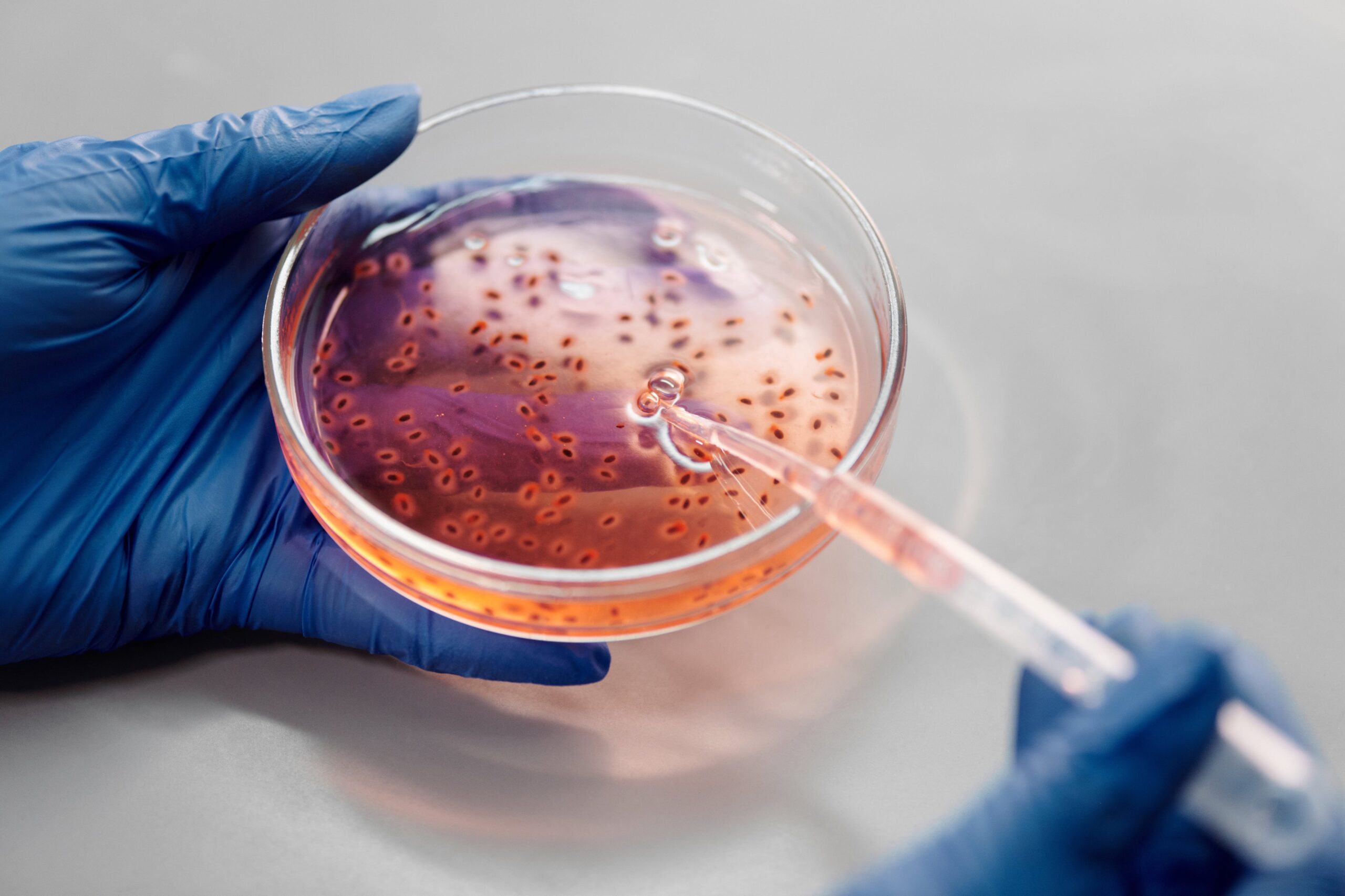 pexels-edward-jenner-4031442 Five things you should do if you must take antibiotics!